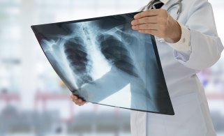 Médico analisando uma radiografia de tórax